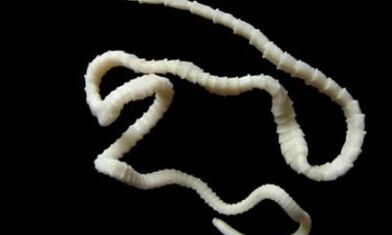 nola kendu zestodo parasitoa gorputzetik